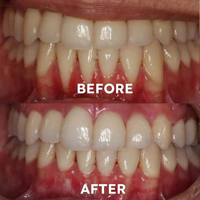 Ourlyard™ Tooth Powder