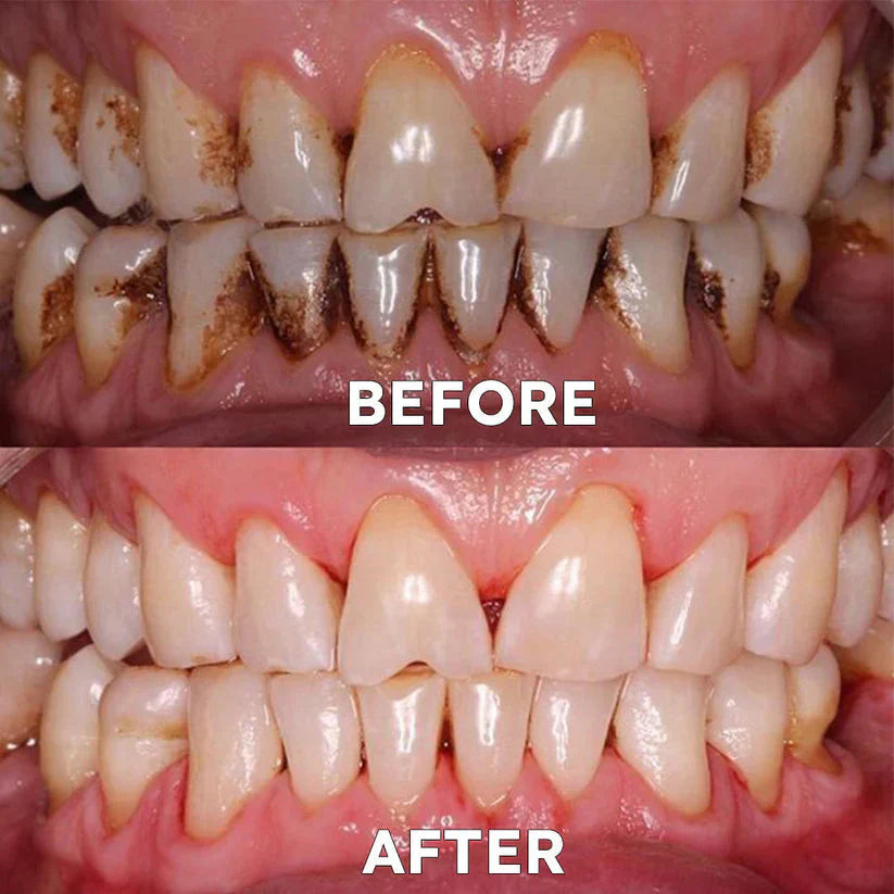 Ourlyard™ Tooth Powder