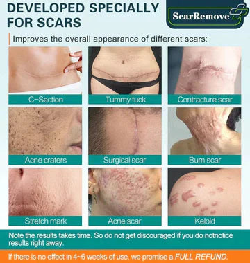 Advanced Scar Spray