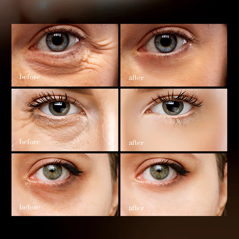 Sadoer™ Anti-Wrinkle Eye Cream